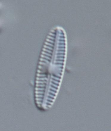 som är typiska för näringsrika miljöer Amphipleura pellucida, Cocconeis placentula-gruppen (framsidans foto) samt Ulnaria