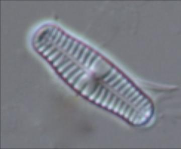 Från vänster: Amphora pediculus-gruppen, som är näringskrävande, noterades framför allt i Oppmanna kanal.