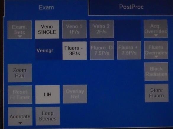 Läkemedel Carbocain 10 mg/ml Isuprel 0,1 mg (0,5 ml) Isuprel spädes med 100 ml NaCl = 1μg/ml färdig lösning. (Se rutin isoproterenolhydrochloride (Isuprel) El-Fys undersökning) Heparin 5000E/ml Ev.