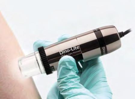 Dino-Lite medicinsk Dino-Lite DermaScope tillgängliga modeller: Med Dino-Lite DermaScope har en ny generation av kompakta DermaScope Polarizer MEDL4DW DermaScope Polarizer 200x MEDL4DM och prisvärda