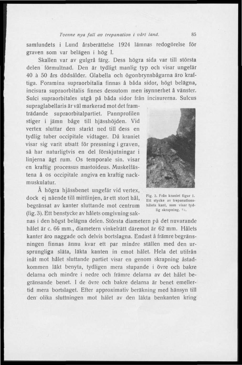 Tvenne nya fall av trepanation i vårt tand. 85 samfundets i Lund årsberättelse 1924 lämnas redogörelse för graven som var belägen i hög I. Skallen var av gulgrå färg.