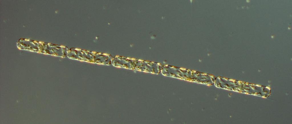 The Baltic Sea BY2 22 nd of September The community at this station was quite diverse. Aphanizomenon flos-aquae was found in quite high cell numbers, as well as the diatom Dactyliosolen fragilissimus.