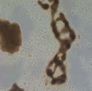Vombsjö Microcystis aeruginosa (69%)