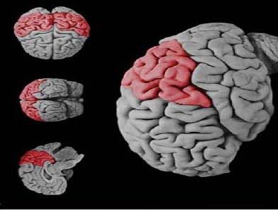Parietal cortex and attention The parietal cortex is a primary Cortical regions governing attention Neglect syndrome often occurs after parietal lesion, particularly in the right hemisphere Right