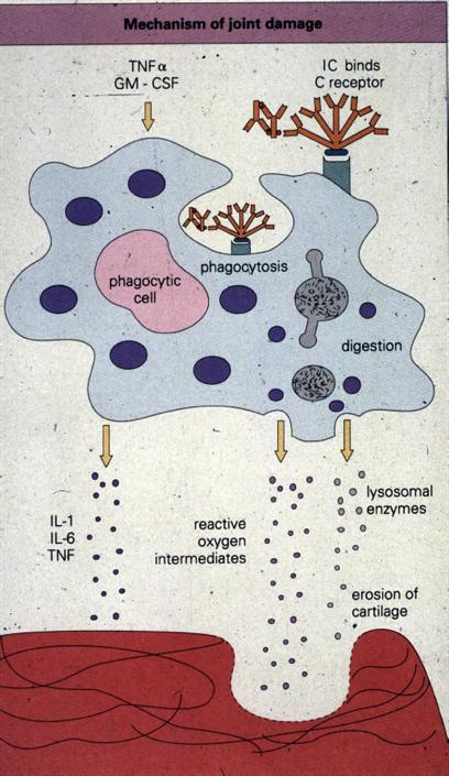 Mechanisms The cytokine release causes: carblage destrucbon fibroblast