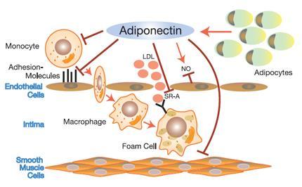radikaler (4,5). Oxiderat LDL (oxldl) i intiman och de aktiverade endotelcellerna attraherar cirkulerande monocyter (3).