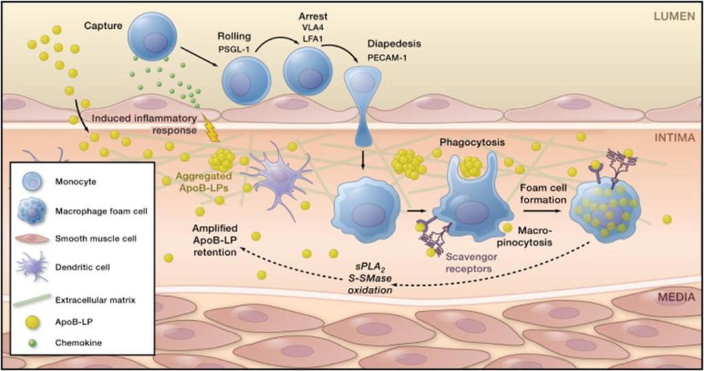 endotelvävnaden och glattmuskelceller kapslar in kärnan (3,4). Figur 2. Omvandlingen av makrofager till skumceller Referens: Moore KJ, Tabas I. Macrophages in the pathogenesis of atherosclerosis.