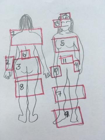 Figur 2. Lokalisation på siffrorna i tabell 8. I två av studierna fick deltagarna fortsätta använda de läkemedel de använt innan.