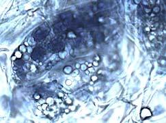 Root cortex