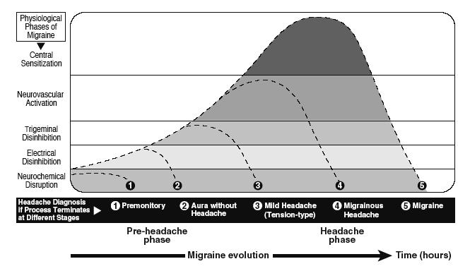 Migraine