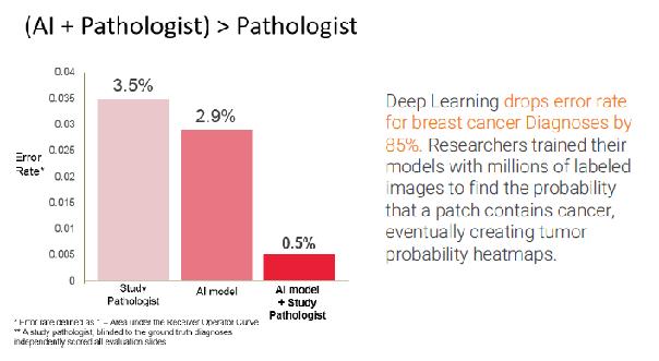 Förstärkande AI Maskininlärning minskar felen för diagnos av bröstcancer med 85%. Tränades med miljoner bilder.