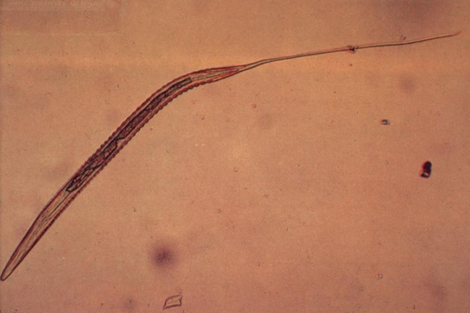Figur 1. Cyathostominae i L3-larv stadium. Foto: Eva Osterman Lind, St