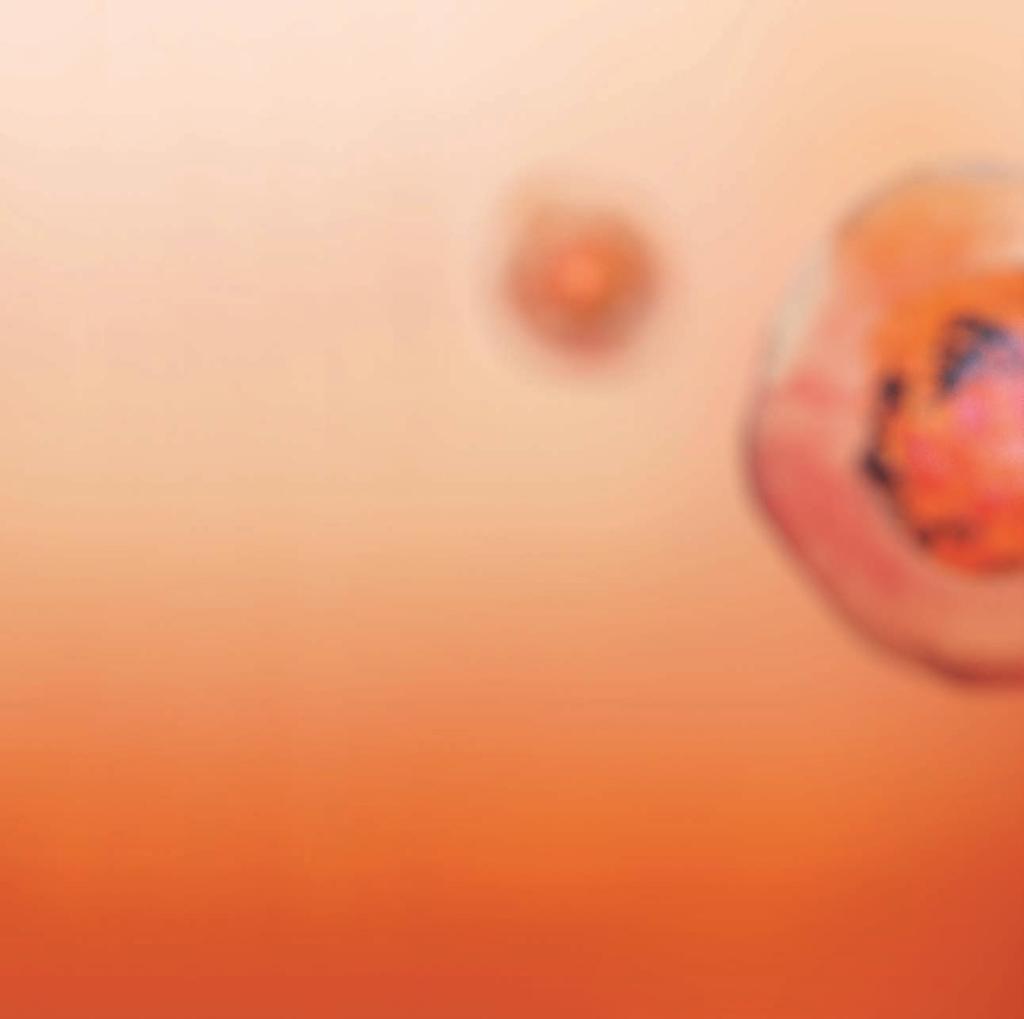 Förbättrad cancerdiagnostik med 3D-mikroskopi Den senaste tidens landvinningar inom ljusmikroskopi kan användas kliniskt för att förbättra patologisk diagnostisering av tumörer.