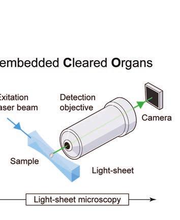 Figur 1. Förenklat flödesschema för DIPCO-protokollet som visar hur FFPE-preparat behandlas för 3D-avbildning med Light-Sheet-mikroskop. Linjerna i rutnätet är åtskilda med 3 mm.