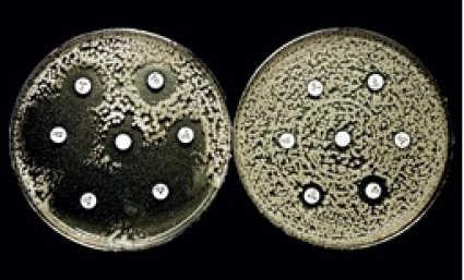 Resistenta bakterier MRB= MultiResistenta Bakterier MRSA= Meticillin Resistent Staphylococcus Aureus VRE= Vancomycin Resistenta Enterokocker ESBL= Extended Spektrum Beta-Lactamase(tarmflora)