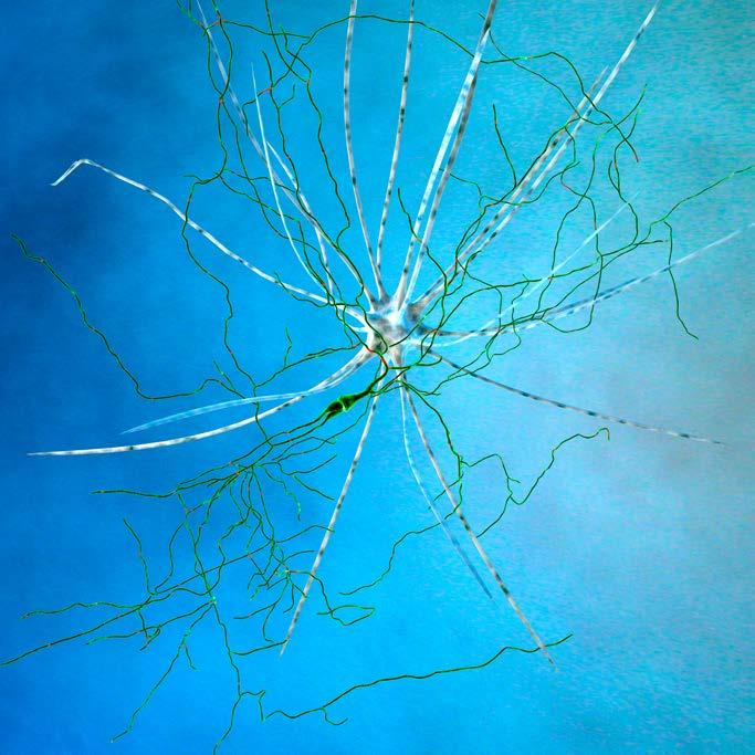 FORSKNING & UTVECKLING Parkinsons sjukdom, nätverk av neuron.