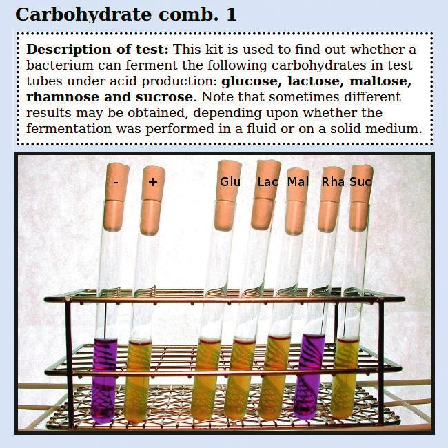 Sida 35 FIGUR 9. Exempel på resultat från en kolhydratfermentation med bakterier från ett av fallen i VetBactLab. De två första rören representerar en negativ och en positiv kontroll.