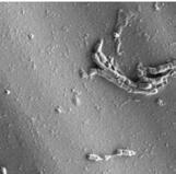 Lösningen Effekt In vitro-test Den minskade mikrobiella adhesionen och koloniseringen på ytan av produkterna har verifierats för kliniskt relevanta stammar in vitro.