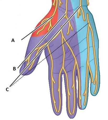 9. Vilka spinala nerver motsvarar A-C i figuren nedan? Notera nervernas olika innervationsområden som i figuren representeras av röd, lila resp. turkos färg. (1,5 p) 10.