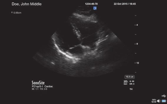 Den kliniska monitorn visar ultraljudsbilden samt information om undersökningen och systemstatus.