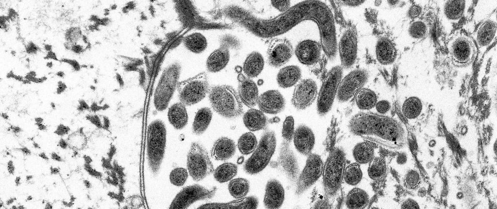 Med hjälp av 16S rrna-genanalys har man hittat spiroketer med nästan samma 16S rrna sekvenser hos djur drabbade av smittsamt klöveksem över hela världen, detta styrker att det är Treponema spp.