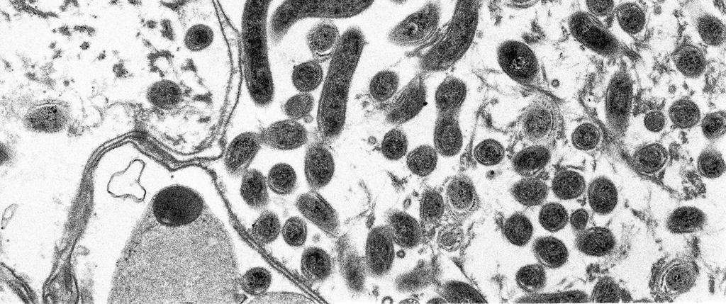 Men vid immunohistokemiundersökning av djur med smittsamt klöveksem så fann man Treponema spp., speciellt djupt in i såren, hårfolliklarna och talgkörtlarna (Evans et al., 2009).