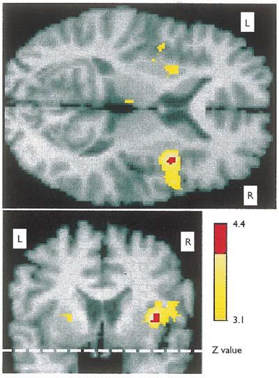 Esser et al, Front