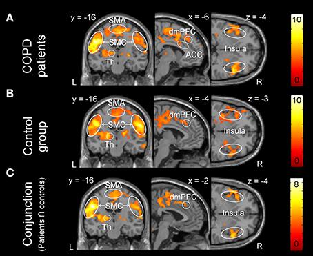 Banzett et al,