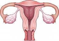 Skydd mot cancer Ovarialcancer Komb metod reducerar risken att dö i ovarialcancer med hälftenoavsett hur länge du använt metoden 1,2 Endometriecancer (corpuscancer) Komb metod reducerar risken