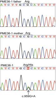 FISH-teknik för kromosomanalys 1990-tal: En doktorsavhandling per gen; jakten på det kompletta