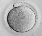 Q-IVF är ett av världens mest kompletta kvalitets-register över IVF-behandlingar med