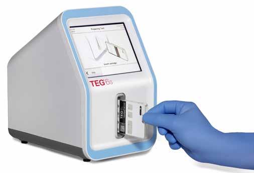 Preoperative Tromboelastografi (TEG) med Platelet Mapping Assay (PMA) Underlätta beräkningen av nödvändiga transfusioner till patienter som genomgår exempelvis hjärtoperationer.