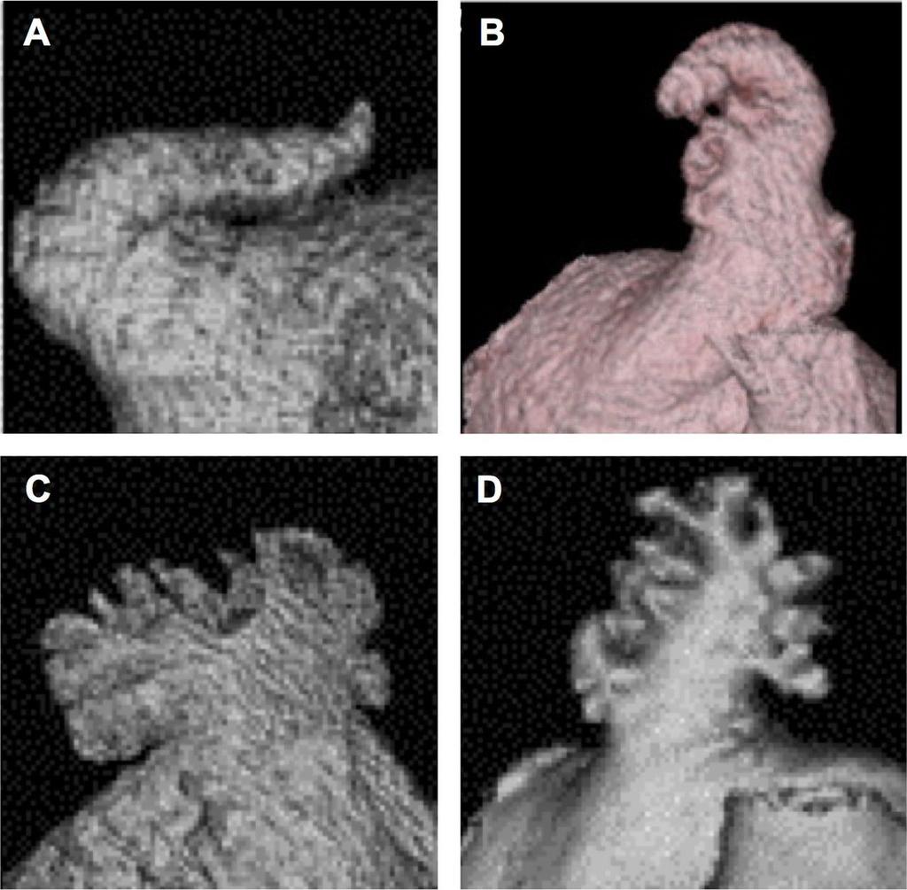 LAA can be classified into four types: (A) chicken wing type with a short neck and