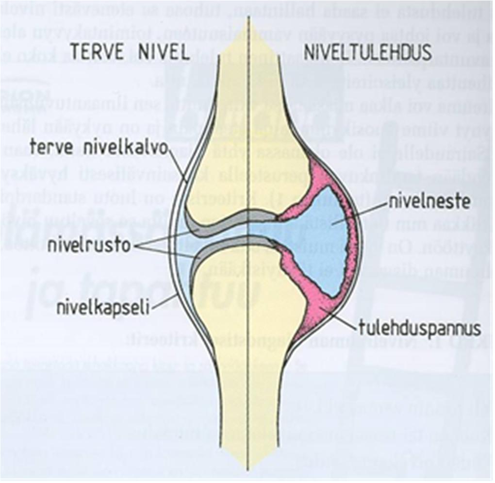 Även om sjukdomen inte helt kan botas, kan man genom tidig och helhetsinriktad behandling lindra symtomen och rentav bli symtomfri. Det viktiga är att du själv är aktiv och engagerad i egenvården.