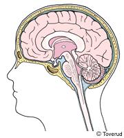 MEDICINER: SE SEPARAT MEDICINLISTA TYP AV STROKE: