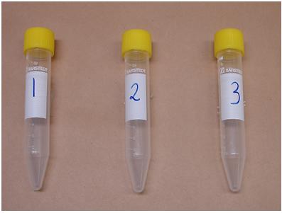 10 (16) Cerebrospinalvätska (Spinal, Liqvor) Cerebrospinalvätska samlas i sterila polypropylenrör med (gul) kork.