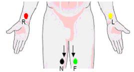 Det är risk för överhettning. Ta inte ur sladdarna ur EKG-dosan. Om de sätts tillbaka på fel ställe blir alla EKG fel. Alla viloekg som tas lagras i en databas.