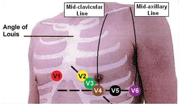 För att detta ska fungera och man ska kunna hitta tidigare undersökningar är det viktigt att sända från EKG apparaten till databasen med korta intervall. Tänk också på detta vid EKG-registreringen: 1.