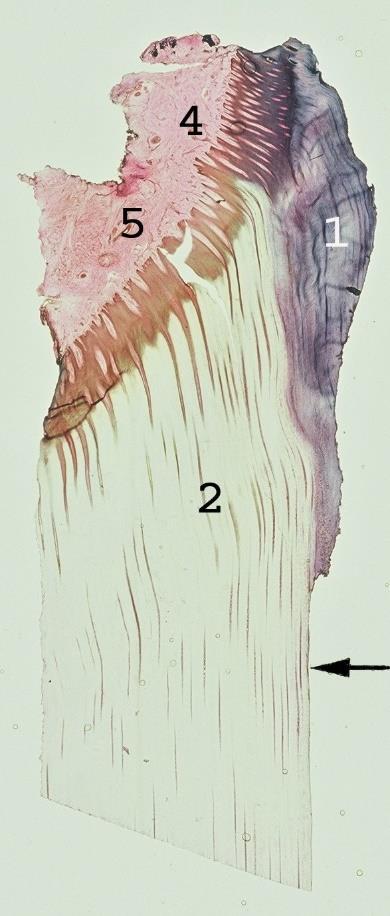 Den högra figuren visar ett histologiskt snitt av hovväggens mest proximala del färgat med