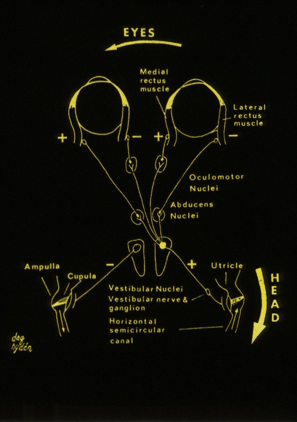 Nystagmus