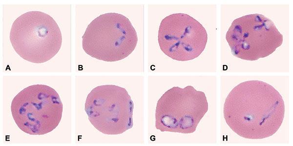 Babesia divergens (sommarsjuka) Intracellulära protozoer besläktade med koccidier och Toxoplasma Transovariell och transstadiell överföring Enzootisk stabilitet: kalvar <1år gamla resistenta ( omvänd