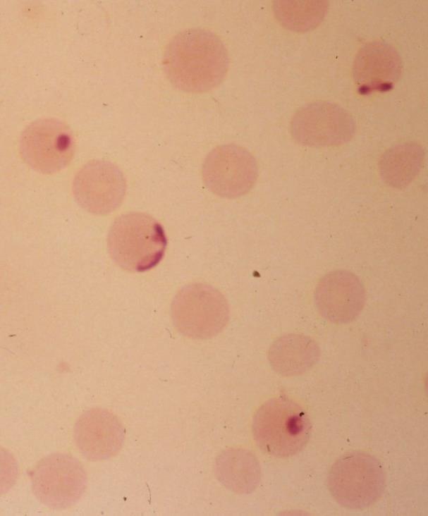 BABESIA B.