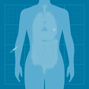 16 Tumörselektivitet via EPR-effekten ger förutsättningar för bättre precision i MR-diagnostik och radionuklidbehandling A B C