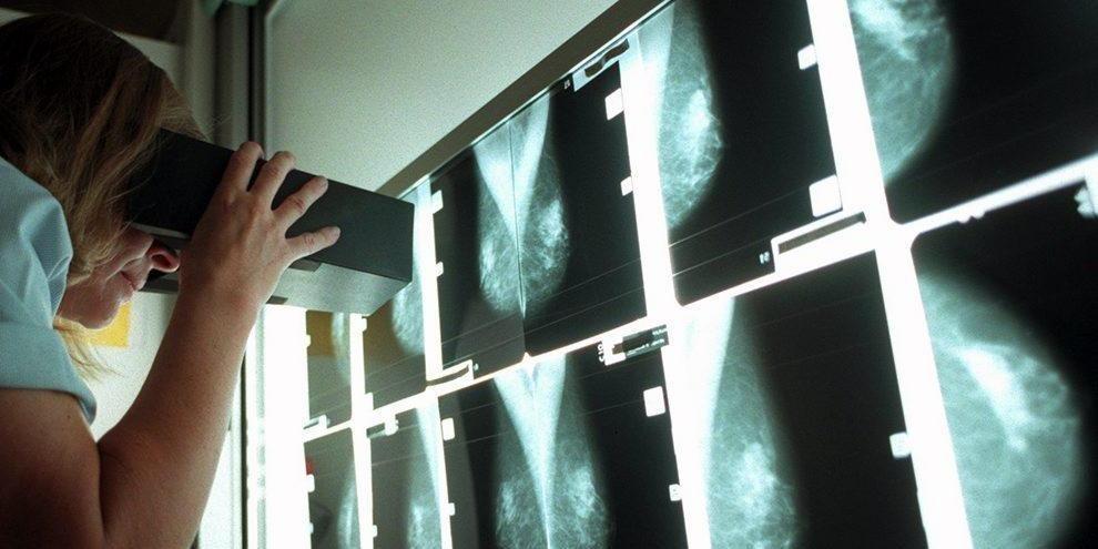 Tidig upptäckt screening, tidig diagnos i akutoch primärvård Screening Mammografi svagt ökat deltagande 85,5 %. Dubbelgranskning. Screeningintervall. Nationellt register under uppbyggnad.