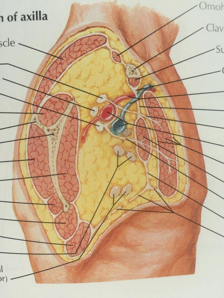 Supraclavicular nerve block.