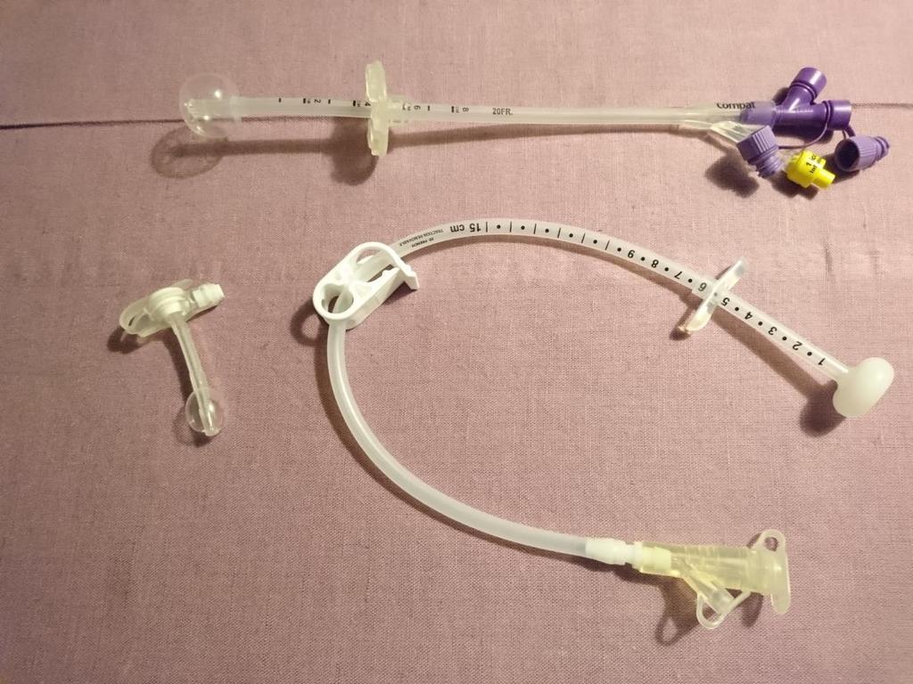 Överst ses en gastrostomikateter med ballong, den lila kopplingen är den nya säkerhetskopplingen för matning Nedanför till höger ses en PEG, den dras genom bukväggen inifrån och ut.