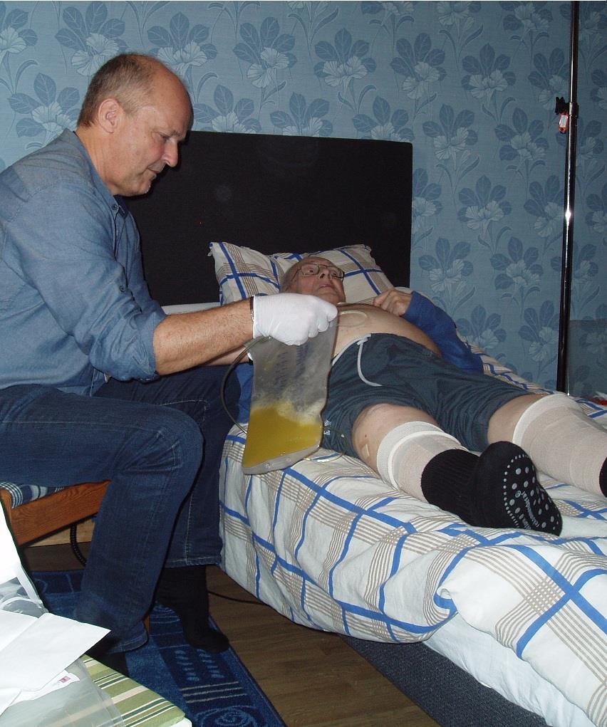 Distriktssköterska tappar via Pleur-X i