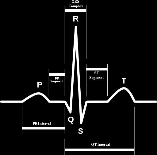 INLEDNING Elektrokardiogram (EKG) är en av de viktigaste undersökningarna för att undersöka hjärtats tillstånd och funktion.