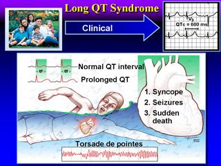 LQTS diagnos Schwartz scoring för sannolik LQTS Familje anamnes Symptom debutålder? helt/delvis medvetslös? abrupt debut?