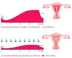 Dysmenorre 50 90% av kvinnor Allvarlig hos 15% Endometrios 10 15%? ökar? Orsak: retrograd mens?